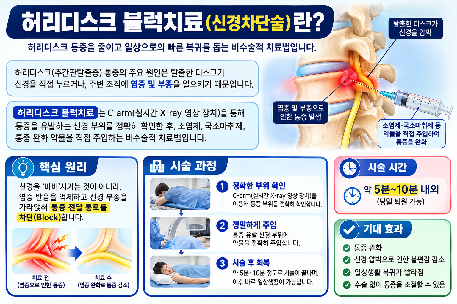 허리디스크 신경차단술 완벽 정리: 치료 효과부터 주의사항 4가지까지