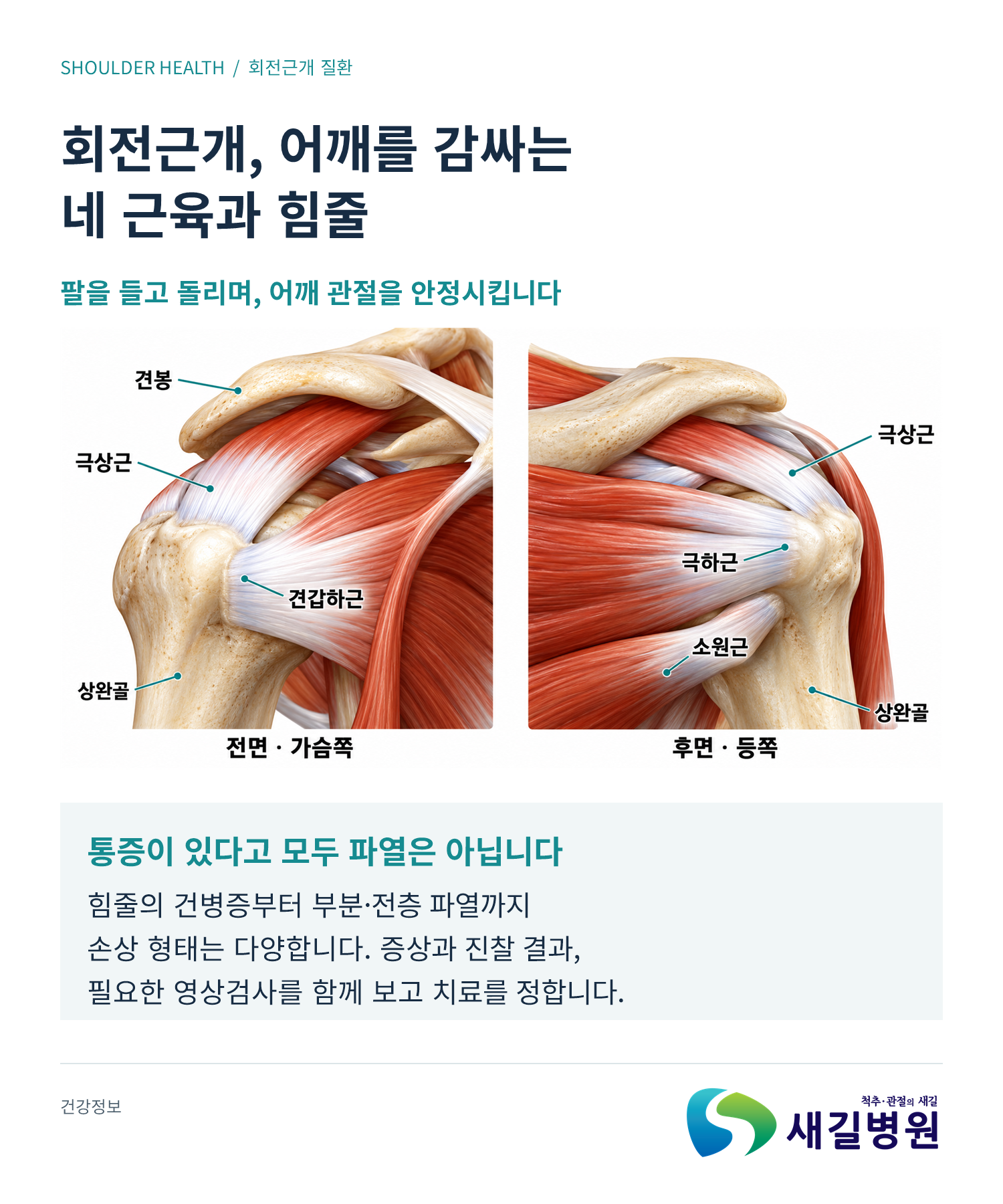 회전근개 질환, 어깨 통증 자가 체크 3가지 | 새길병원